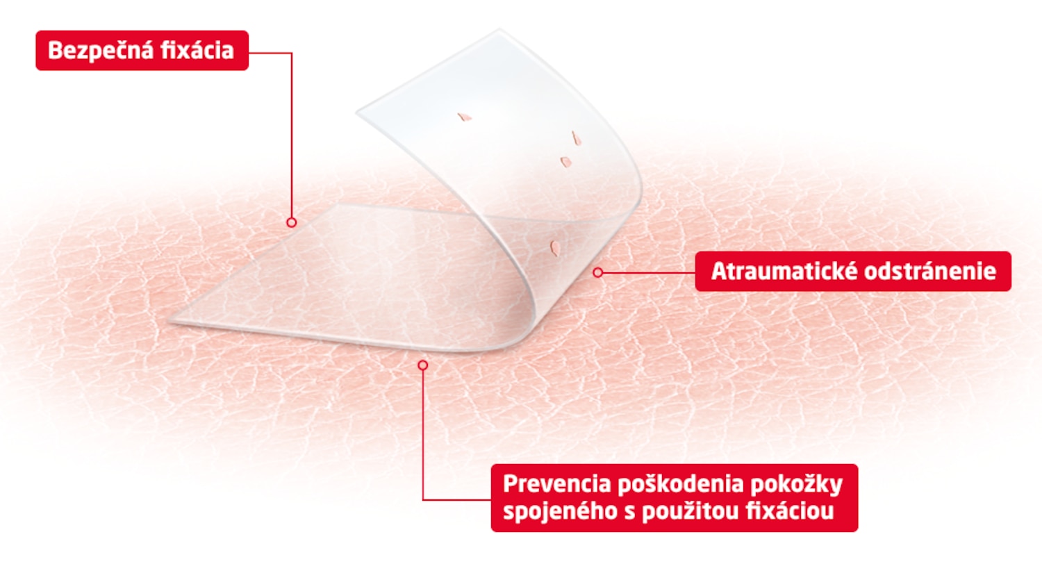 Obrázok znázorňujúci výhody technológie produktu pre citlivú pokožku: bezpečná fixácia, atraumatické odstránenie a prevencia poškodenia pokožky spôsobené lepidlom.