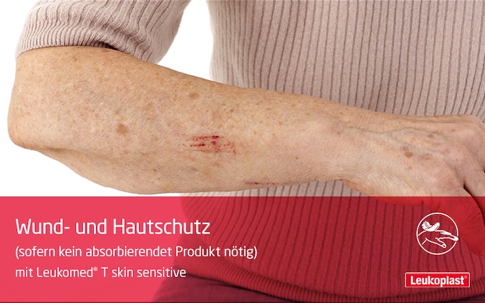 In diesem Video demonstrieren wir den Einsatz des transparenten Wundverbands auf fragiler Haut. Das Fachpersonal platziert Leukomed® T skin sensitive auf der Unterarmverletzung einer älteren Frau.