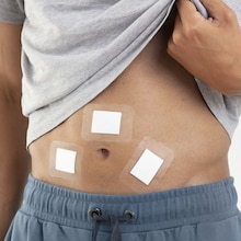 Leukomed Sorbact by Leukoplast on abdomen