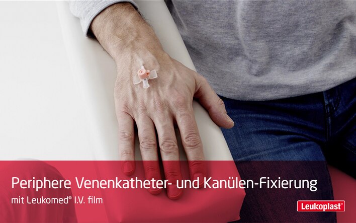 Dieses Video zeigt die Fixierung eines Injektionszugangs mit Leukomed® I.V.: Das Fachpersonal befestigt eine Kanüle mit Leukomed® I.V. film auf dem Handrücken des Patienten.