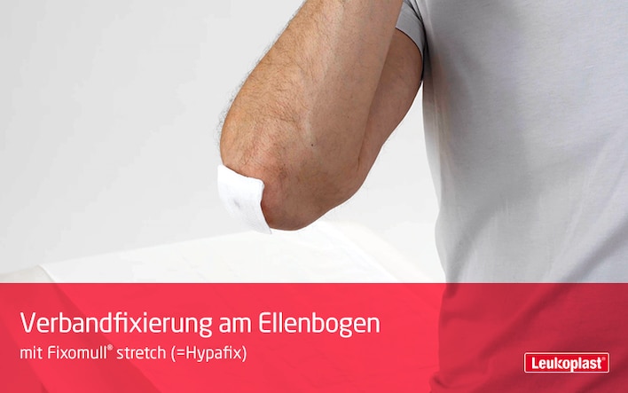 In diesem Video zeigen wir den Einsatz von Fixomull® stretch als Verbandfixierung an einem Gelenk: Das Fachpersonal platziert den Verband am Ellenbogen des Patienten.