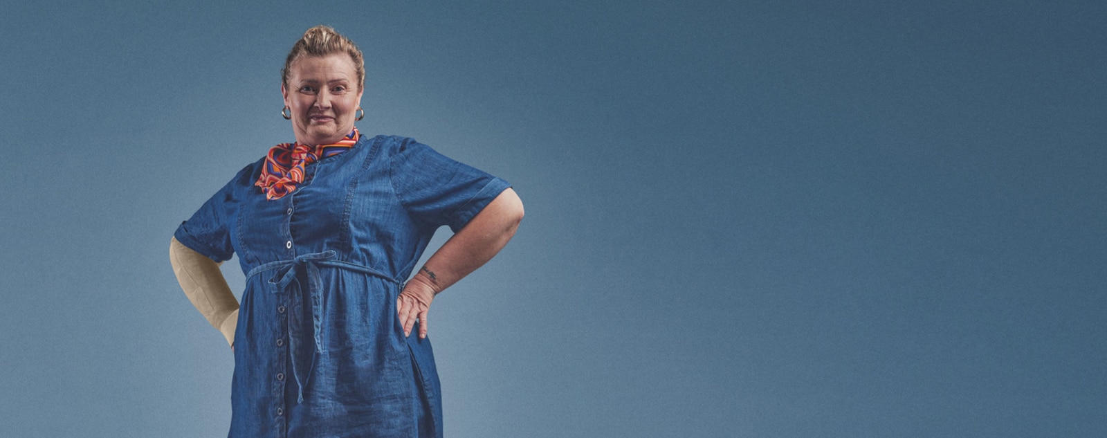 Claire standing with hands on hips, wearing a blue dress and compression sleeve on her right arm.