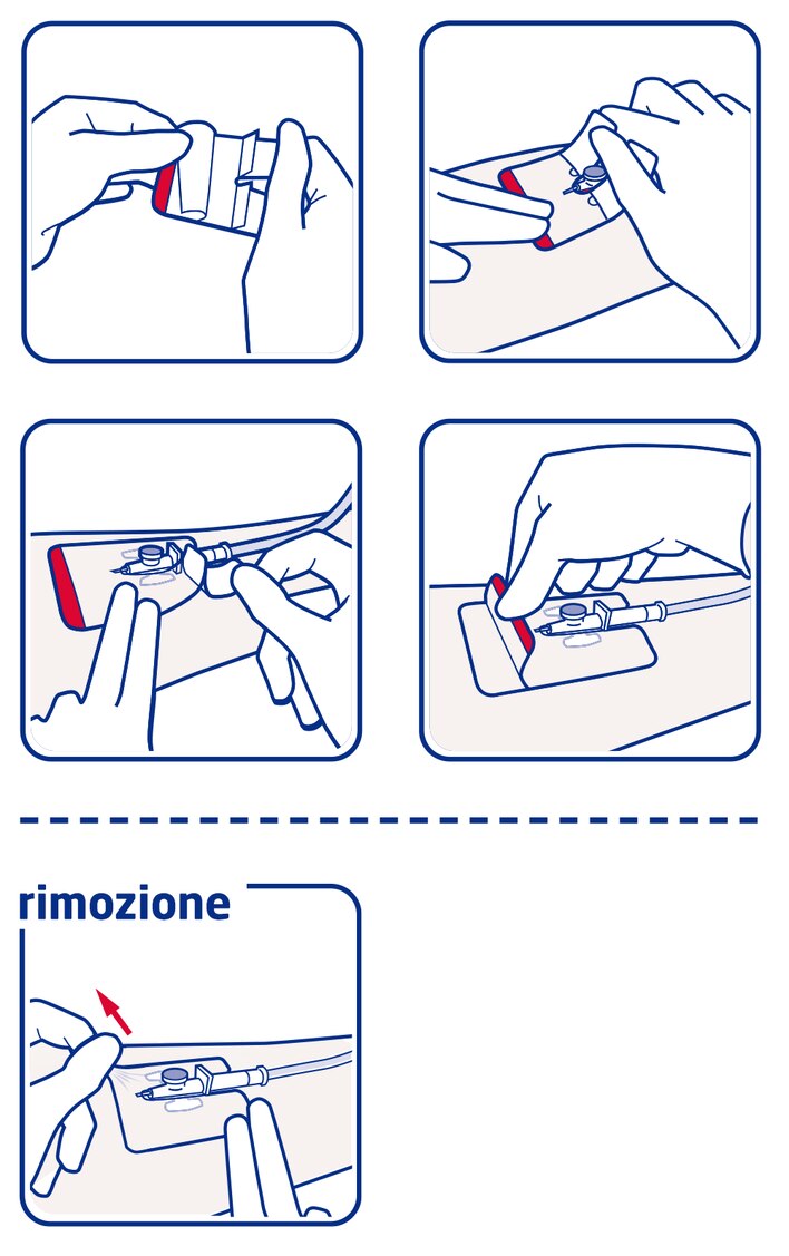 Come utilizzare Leukomed IV film di Leukoplast