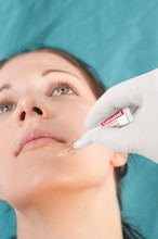 Leukoplast skin adhesive by Leukoplast, close-up Applikation an einem Kinn