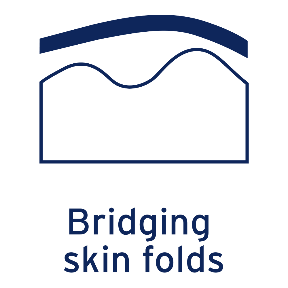 The JOBST Elvarex bridging skin folds technology.