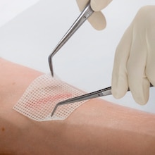 Profesional médico aplicando Leukoplast Cuticell Classic 