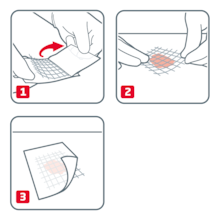 Instrucciones de uso de Leukoplast Cuticell Classic 
1. Retirar la película protectora 
2. Aplicar la gasa sobre la herida 
3. Quitar la película protectora superior 