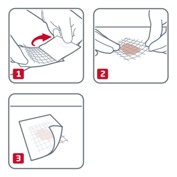 Cuticell classic by Leukoplast usage instructions 
1. Remove the protective film 
2. Apply the wound dressing to the wound 
3. Pull off the upper protective film 