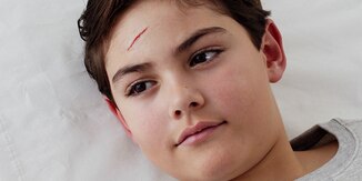 Das Fachpersonal verschließt die Wunde auf der Stirn eines Jungen ohne sie nähen zu müssen.