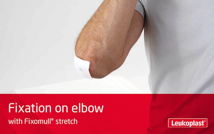 In this video we learn how Fixomull stretch medical tape is used for securing a dressing on a joint: We see the hands of an HCP applying a dressing to the the elbow of a male patient.