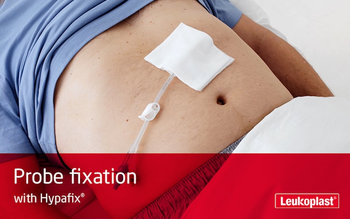 This video shows how to secure a probe with the help of Hypafix stretch medical tape: We see the hands of an HCP attaching a probe to a patient's abdomen.