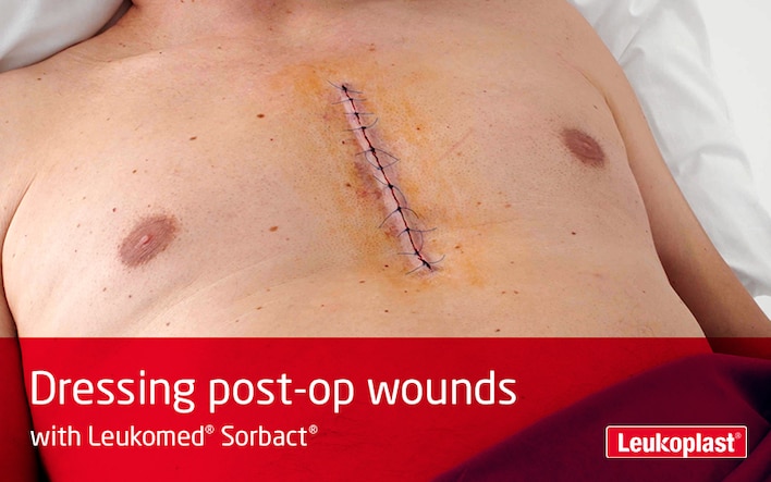 This film shows how large post-operative wounds are cared for using Leukomed Sorbact: we see an HCP dressing a long surgical incision into the chest of a patient.