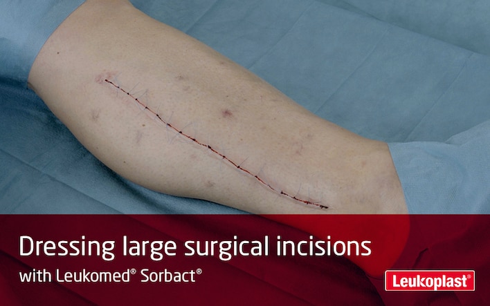 In this video we learn how to dress large post-operative wounds using Leukomed Sorbact: we see an HCP dressing a long surgical incision on a patient's calf.