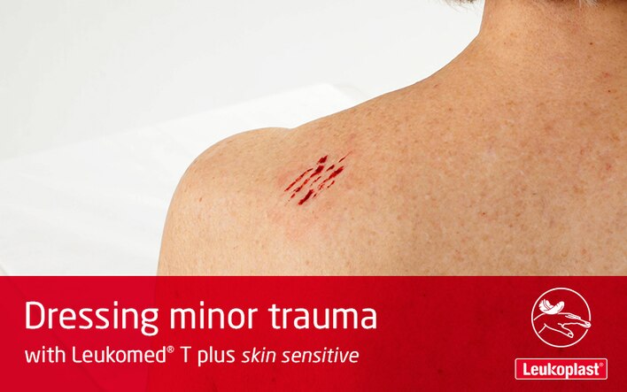 In this video is shown how skin tears can be avoided in ageing skin: We see the hands of an HCP dressing the abrasion on an elderly woman's shoulder using Leukomed T plus skin sensitive.