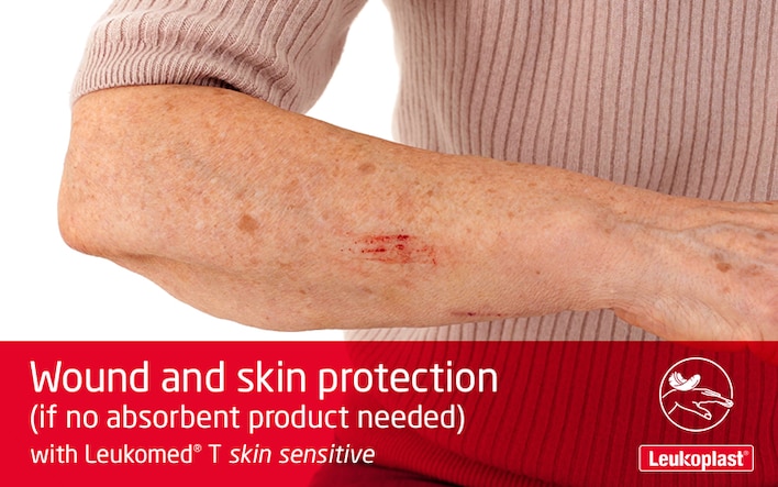 Denne video viser, hvordan en transparent sårbandage med film bruges på skrøbelig hud: vi ser en sundhedspersons hænder, der sætter Leukomed T skin sensitive på en rift på en ældre kvindes underarm.
