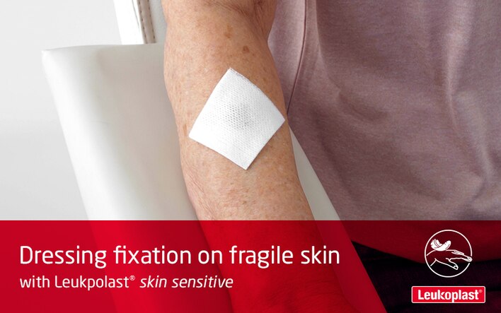 Här ser vi nu hur man använder och byter ut sårförband på väldigt känslig hud med medicinsk tejp. Vårdpersonal sätter fast en sårdyna på en äldre kvinnas underarm med Leukoplast skin sensitive.
