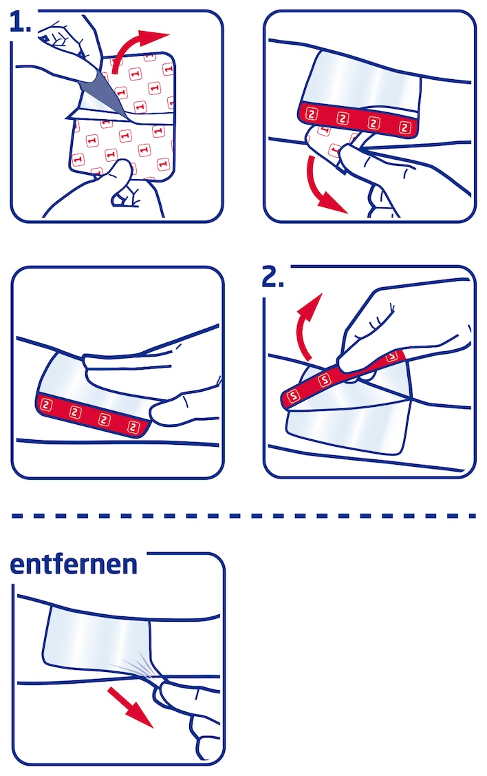 Anwendung von Leukomed T