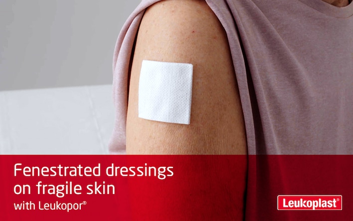Here we can see in close-up how fenestrated dressings are applied to fragile skin with the help of breathable medical tape: the hands of an HCP are fastening a wound pad to the shoulder of an elderly woman with Leukopor tape.