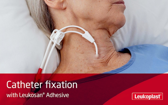 In this video we learn how to secure a catheter using Leukosan Adhesive. We see a HCP's hands attaching a catheter to the throat of an elderly woman.