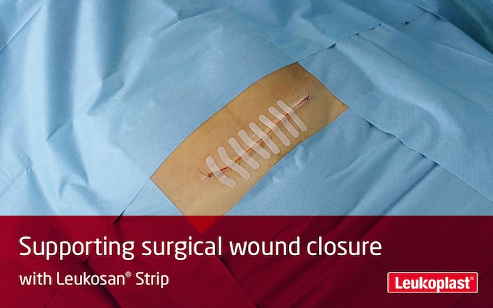 Here we see how to use Leukosan Strip after a cesarean section: We see the hands of an HCP performing a c-section wound closure with the support of wound closure strips. 