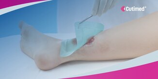 Cutimed, Il potere di guarire