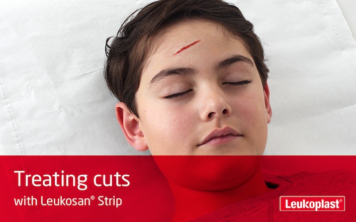 Videoen viser hvordan kuttsår kan lukkes ved å bruke strips for lukking av sår: vi ser et helsepersonell som behandler et kutt i pannen til en gutt ved hjelp av Leukosan Strip.