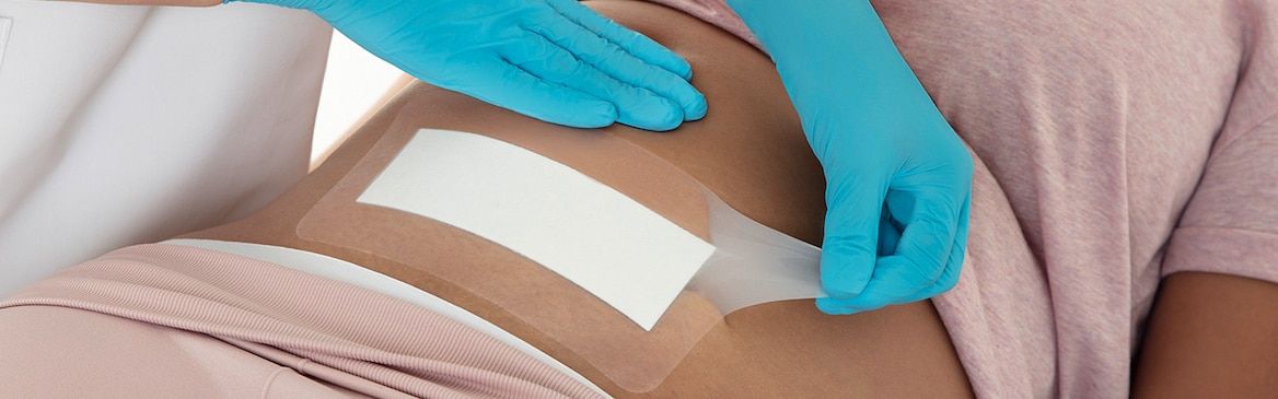 Sorbact technology-coated microbial binding post-op dressings