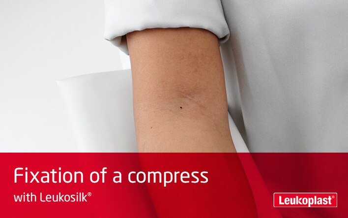 Hier kunnen we in close-up zien hoe een kompres wordt gefixeerd met kleefpleister voor de gevoelige huid: de handen van een zorgmedewerker brengen een wondkussentje aan op de holte van de arm van een patiënt met Leukosilk kleefpleister. 