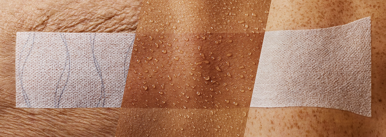 Primo piano di 3 medicazioni di fissaggio applicate su 3 diversi tipi di pelle (medicazione su pelle anziana e rugosa, medicazione trasparente su pelle umida e medicazione stirata su un'articolazione).
