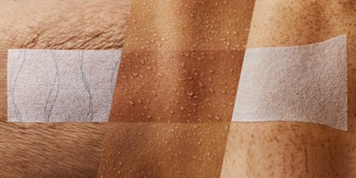Close-up of 3 fixation dressings applied on 3 different skin types (dressing on elderly and wrinkled skin, transparent dressing on wet skin and stretched dressing on a joint)