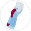pressure pads on hand support