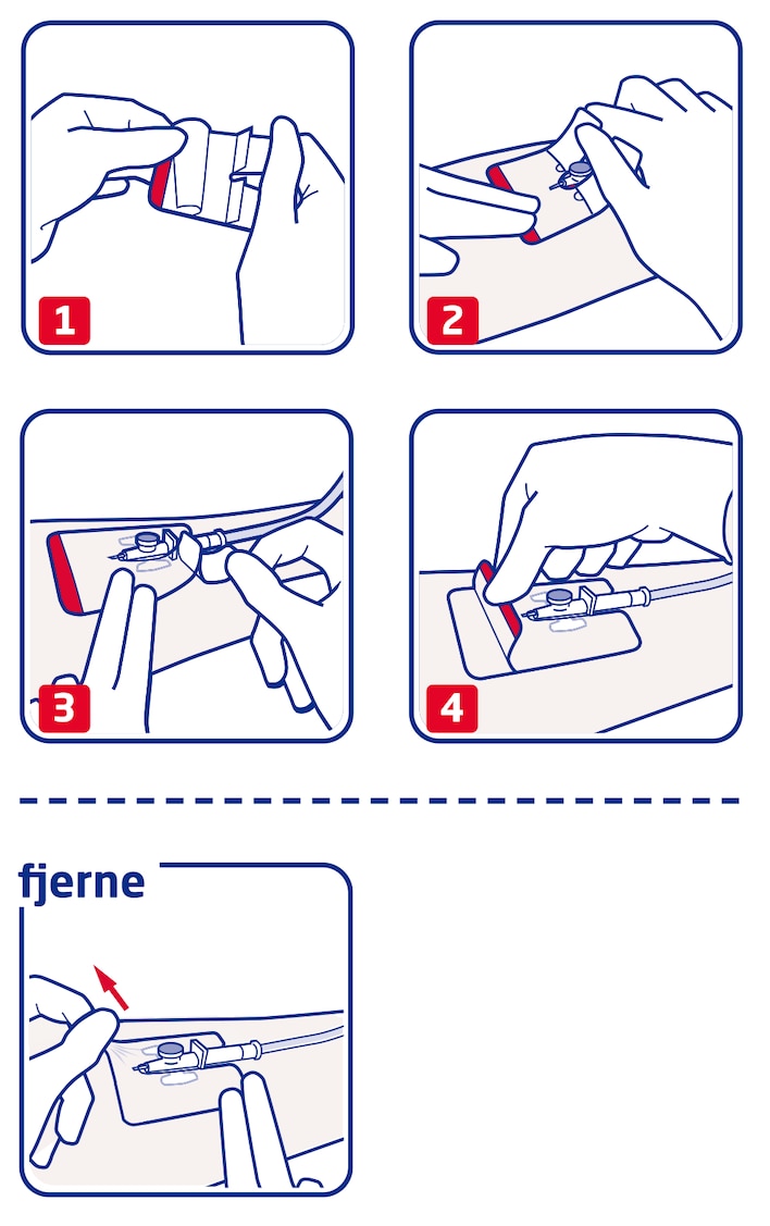 Brugervejledning for Leukomed IV film fra Leukoplast