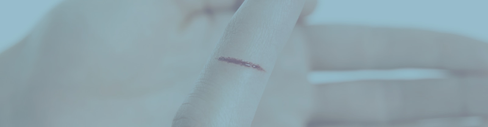 Imagen de corte en un dedo