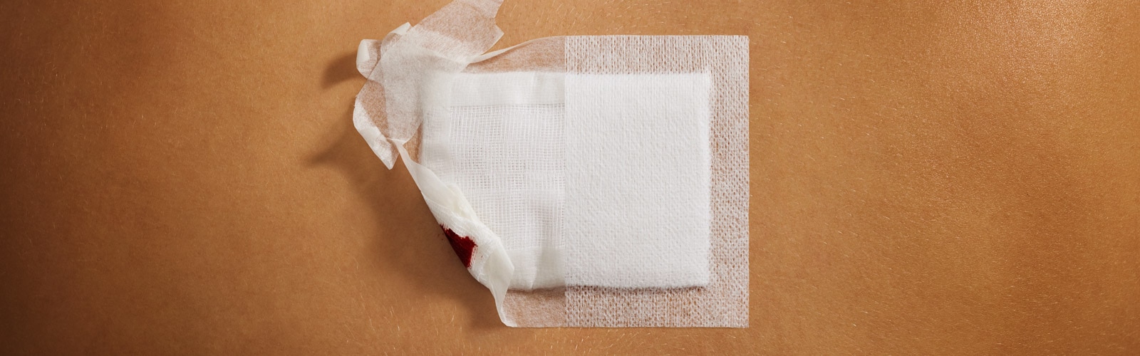 Primer plano comparando los resultados en la piel a lo largo del tiempo del esparadrapo quirúrgico con el parche adhesivo para heridas en zonas amplias.