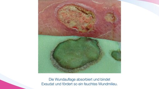 Cutimed Siltec Sorbact B - Produkt Info