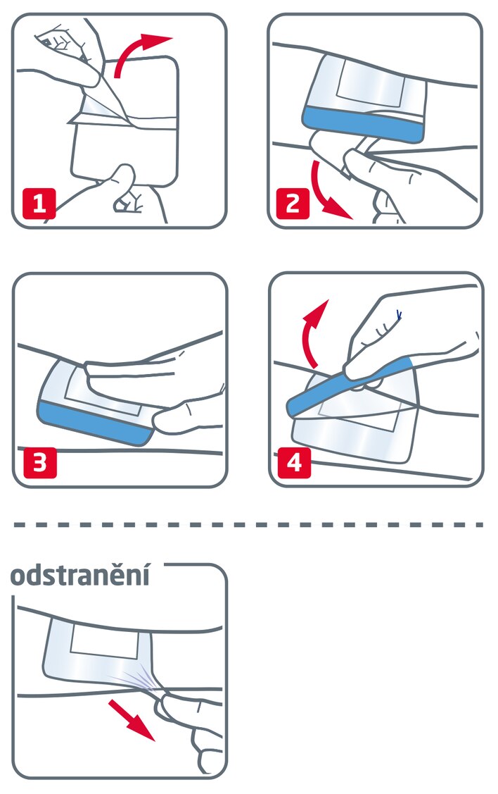 Jak používat Leukomed Sorbact