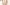 Rótulo com a palavra ligaduras com um ícone de dois pensos cruzados sobre a imagem de uma mulher jovem sentada no chão com uma ferida no joelho esquerdo coberta com gaze e uma ligadura tubular.