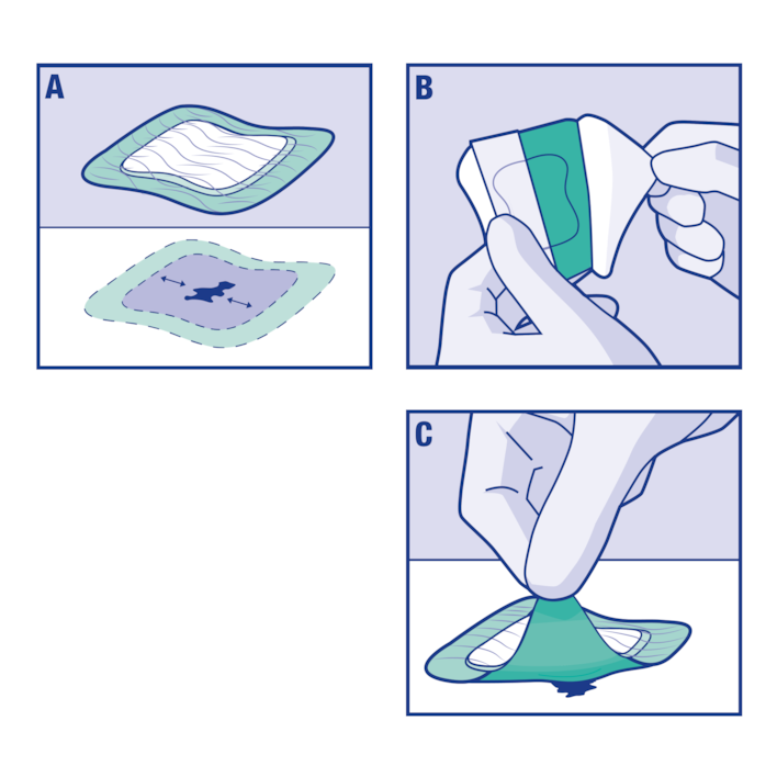 Bilde som viser hvordan du påfører Cutimed® Siltec® Sorbact B
