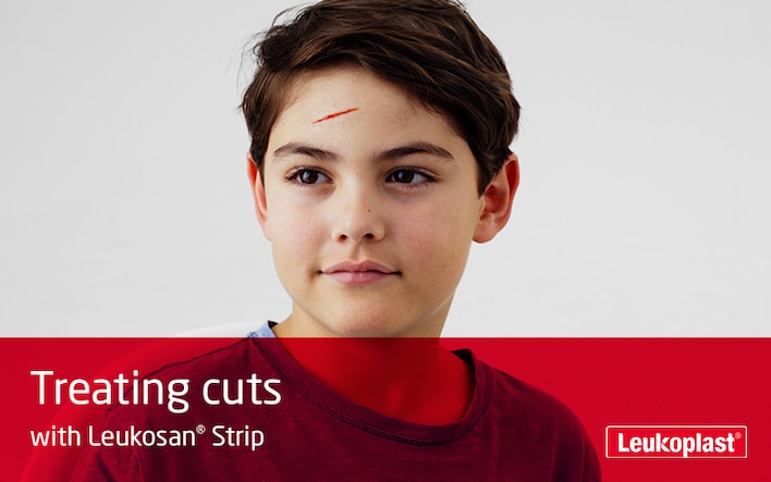 Her vises det, hvordan snitsår kan behandles ved hjælp af Leukosan Strip: Vi ser et nærbillede af to hænder, der ved hjælp af suturstrips lukker et sår på en drengs pande.